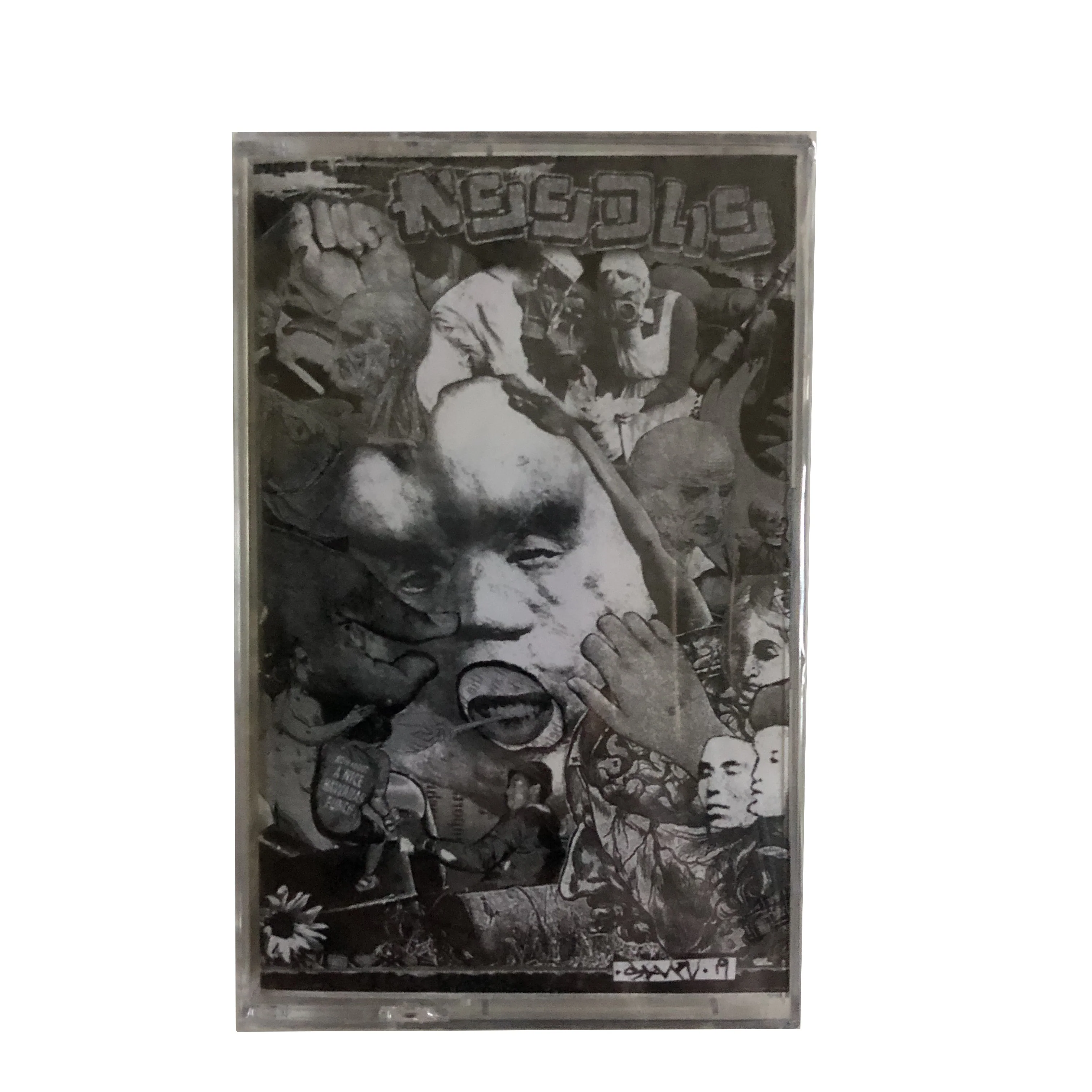 Needle: S/T cassette